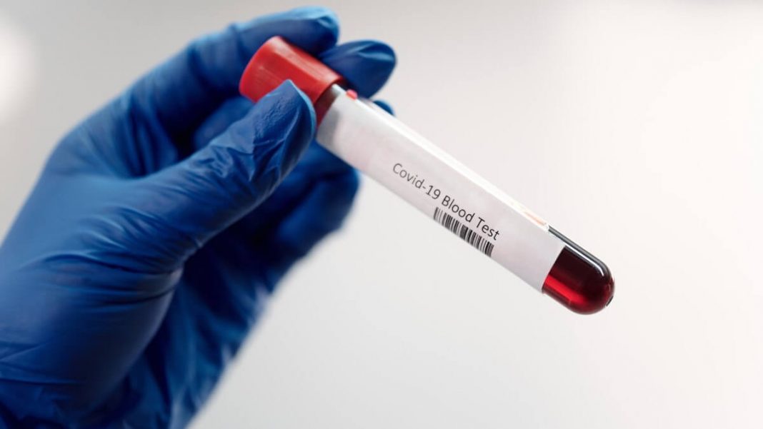 person holding coronavirus blood test plastic bottle