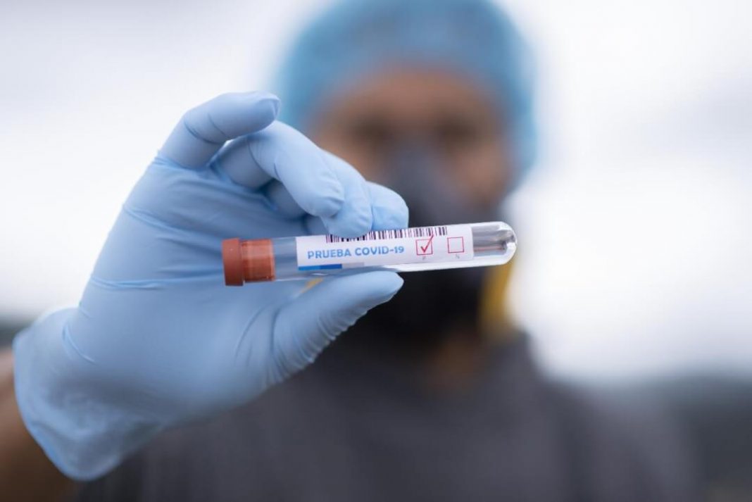 positive test result for covid19
