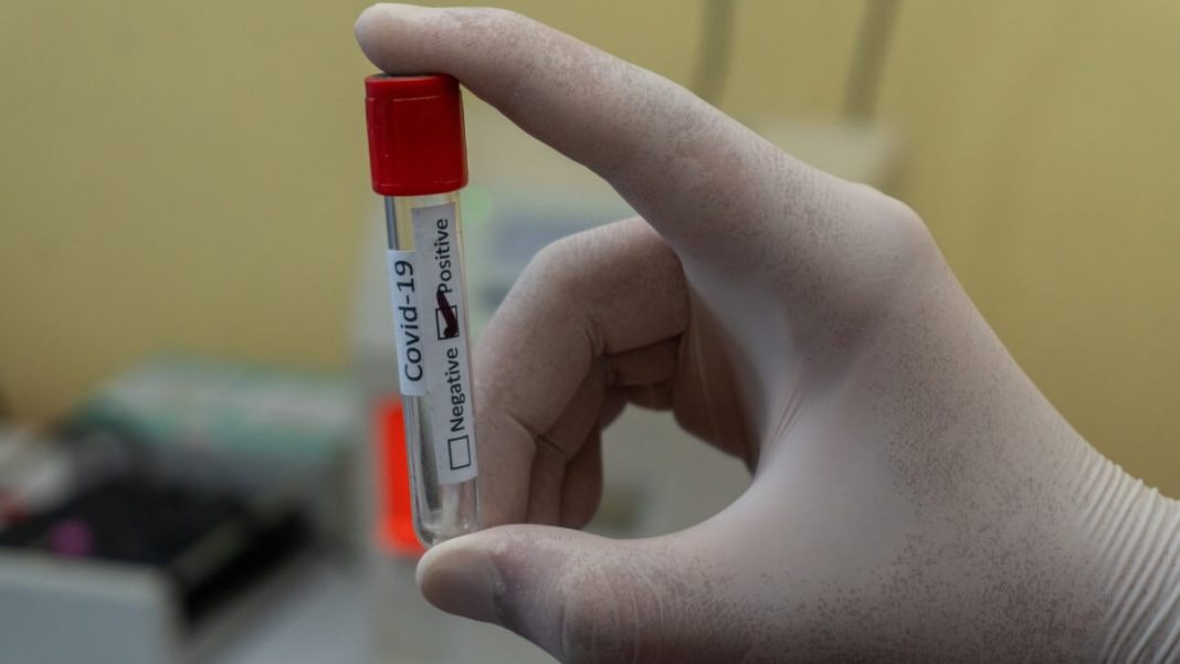 person holding covid-19 positive result